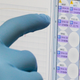 A researcher examining blood test results at Gorgas Memorial laboratory in Panama City in 2016 (stock photo).